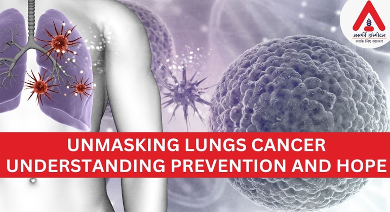 Unmasking Lung Cancer
